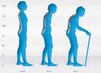 Εκδήλωση για την oστεοπόρωση