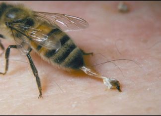 Το κεντρί της μέλισσας σκότωσε 48χρονη Αγρινίωτισσα!