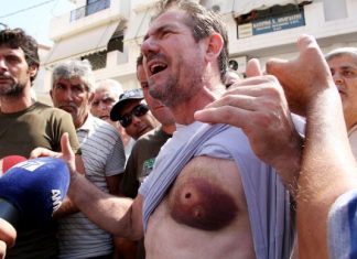 Αιτωλικό…. και μη χειρότερα…