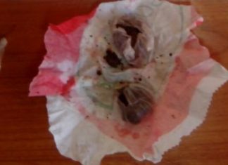 Συνελήφθη 34χρονος με ηρωίνη στο Αγρίνιο