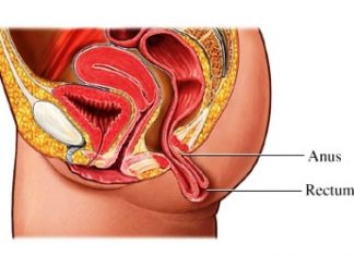 Παθήσεις παχέος εντέρου: Η λαπαροσκοπική χειρουργική είναι η λύση