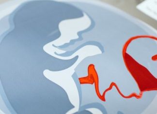 Εκδήλωση στο Αγρίνιο με θέμα: “Δωρεά Οργάνων Σώματος και Ομφαλοπλακουντιακού Αίματος”