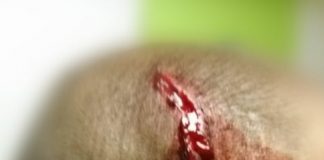 Οργανωμένοι Παναιτωλικού: Απειλή παραίτησης Κωστούλα και επίθεση της ΕΛ.ΑΣ.