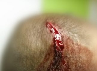 Οργανωμένοι Παναιτωλικού: Απειλή παραίτησης Κωστούλα και επίθεση της ΕΛ.ΑΣ.