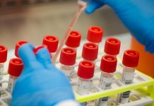 O Ιατρικός Σύλλογος Αγρινίου στηρίζει τις κινητοποιήσεις των Εργαστηριακών Ιατρών