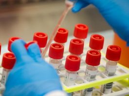 O Ιατρικός Σύλλογος Αγρινίου στηρίζει τις κινητοποιήσεις των Εργαστηριακών Ιατρών