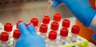 Δύο νέα κρούσματα στην Αιτωλοακαρνανία