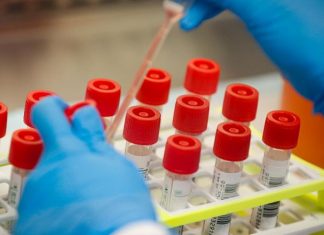 19 νέα κρούσματα στην Αιτωλοακαρνανία