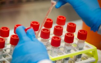 110 νέα κρούσματα στην Αιτωλοακαρνανία