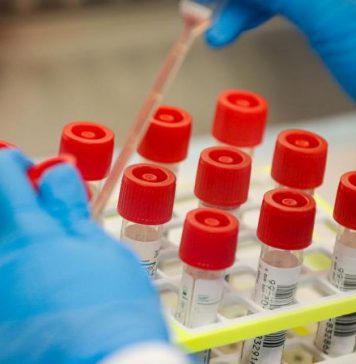 Πέντε νέα κρούσματα στην Αιτωλοακαρνανία