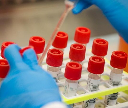 Έξι νέα κρούσματα στην Αιτωλοακαρνανία