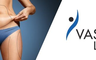 Πείτε αντίο στο περιττό λίπος με vaser και αποκτήστε το σώμα των ονείρων σας