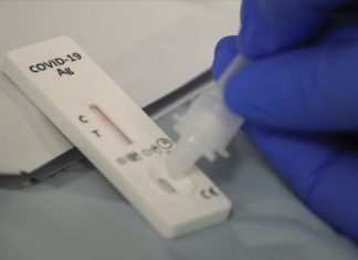 Να καλύπτει η Πολιτεία τα self-test ζητά ο Εμπορικός Σύλλογος Αγρινίου