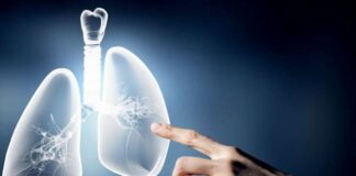 Αγρίνιο: Ημερίδα ενημέρωσης για την έγκαιρη διάγνωση του καρκίνου του πνεύμονα