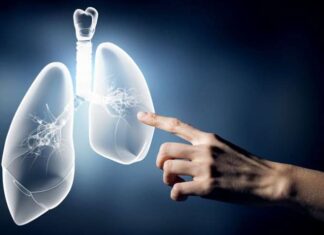 Αγρίνιο: Ημερίδα ενημέρωσης για την έγκαιρη διάγνωση του καρκίνου του πνεύμονα