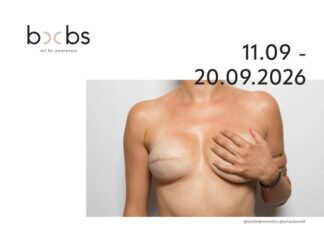 Στη Ναύπακτο η έκθεση φωτογραφίας “boobs – art for awareness” της Σύλβιας Κουβέλη